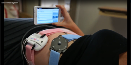 Remote Maternal Fetal Monitoring| Nst From Home| Telemedicine
